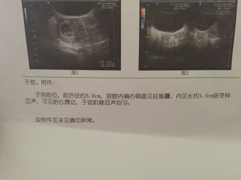 journal_insert_pic_406956233