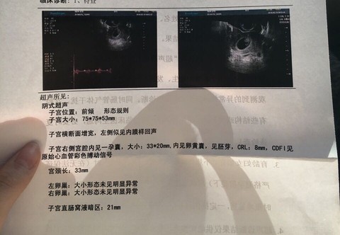 journal_insert_pic_408022169