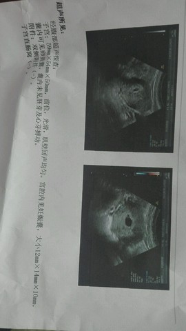journal_insert_pic_408741884