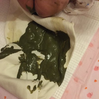 宝宝出生22天喝雀巢的超级能恩,三四天拉一次便便如图,请问有不上火的