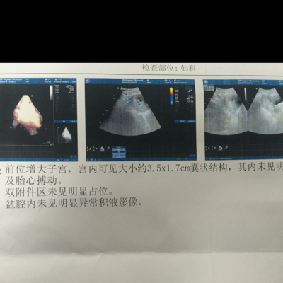 孕8周 1 没看到胎心胎芽 是不是卵黄囊也说看不清 没有腹痛流血 孕4周和5周 的时候都有抽血 Hcg和孕酮值良好 医生建议一周后复诊 有人知道怎么回事么 宝宝树