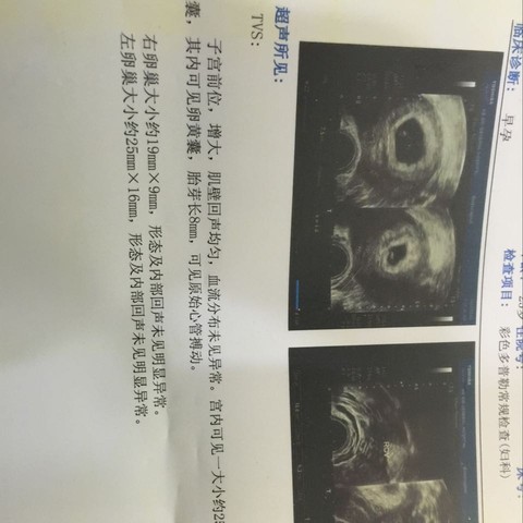 journal_insert_pic_420274740