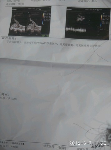 journal_insert_pic_420803370