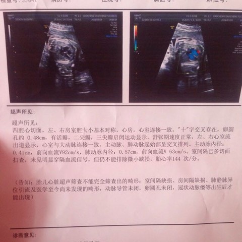 journal_insert_pic_422359197