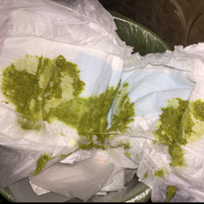 宝宝3个月拉绿屎怎麼回事