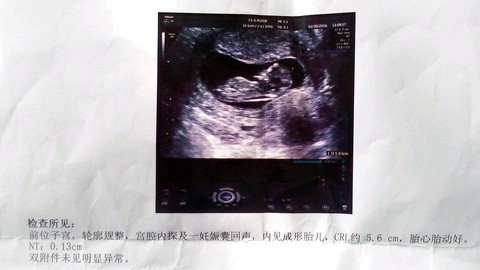 journal_insert_pic_425379340