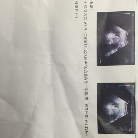 journal_insert_pic_425417615