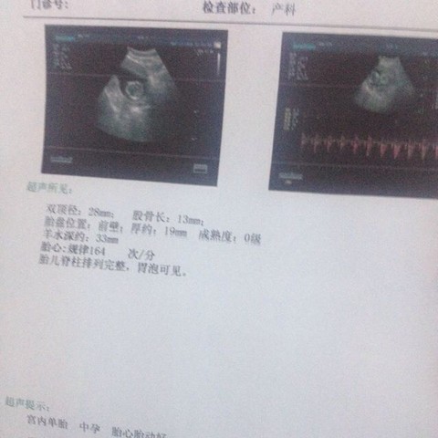 journal_insert_pic_425028111