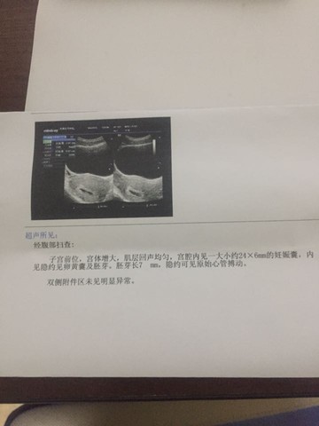journal_insert_pic_426732376