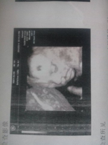 journal_insert_pic_426537952