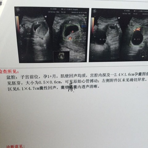journal_insert_pic_427610359