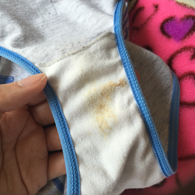 怀孕五周,今天洗澡发现内裤上有褐色分泌物,但擦下面了没有…怎麼办?