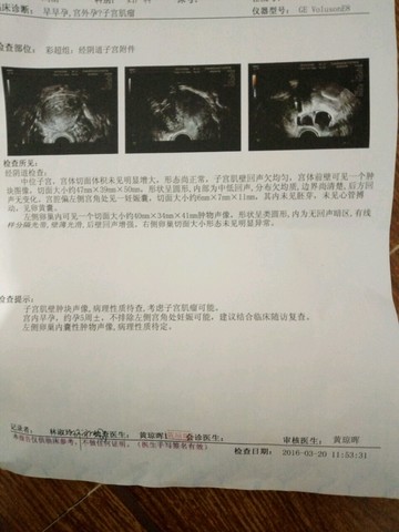 journal_insert_pic_430876873