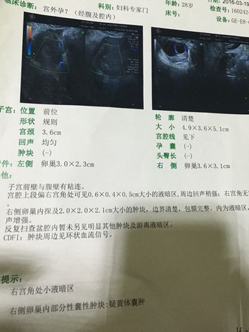 journal_insert_pic_431554296