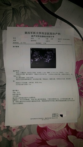 journal_insert_pic_431681336