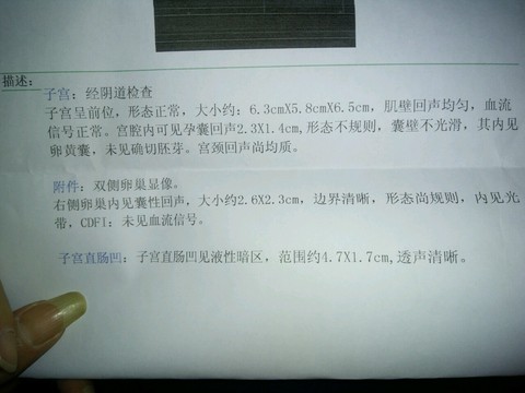 journal_insert_pic_433363040