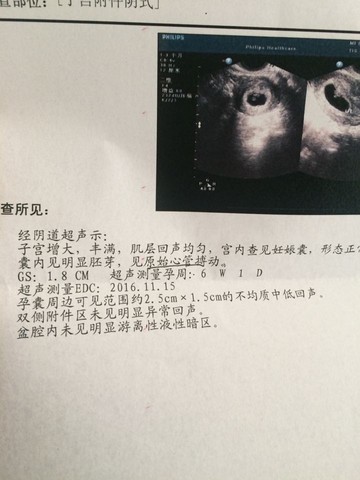 journal_insert_pic_433357172