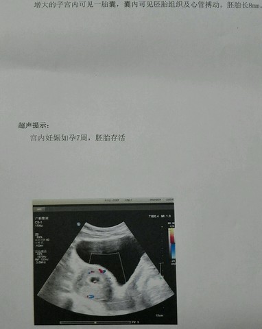 journal_insert_pic_434899683