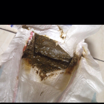 小宝贝今天十三天了,连续拉粑粑三次怎么回事