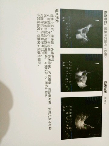 journal_insert_pic_434118345