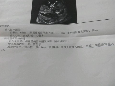 journal_insert_pic_434872374