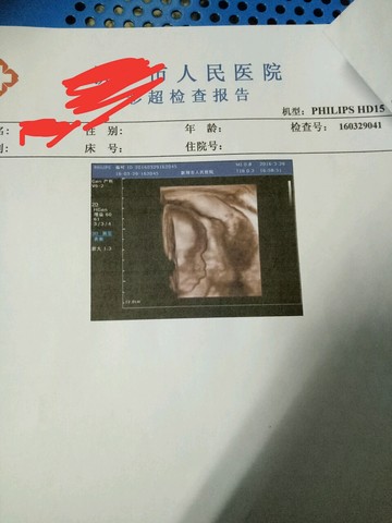 journal_insert_pic_439059823