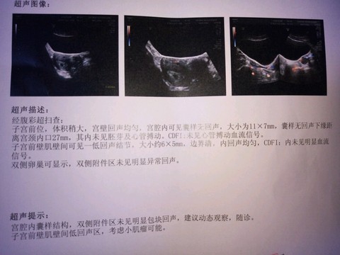 journal_insert_pic_441939084
