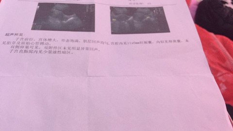 journal_insert_pic_444554030