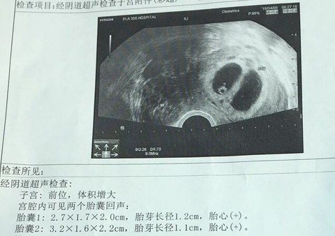 journal_insert_pic_445696921