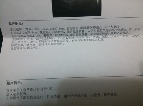 journal_insert_pic_446828011