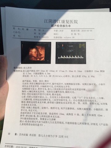 journal_insert_pic_447226672