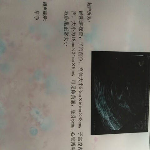 journal_insert_pic_448315332