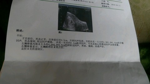 journal_insert_pic_450046071