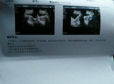journal_insert_pic_450012974
