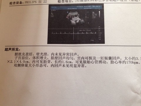 journal_insert_pic_450007905