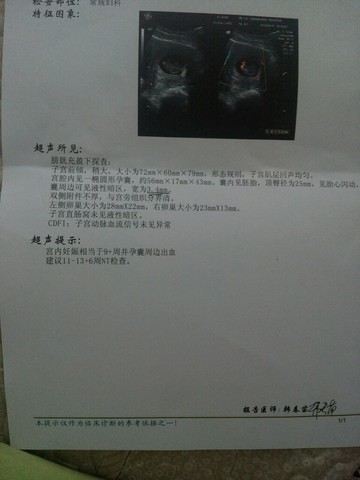 journal_insert_pic_450704455