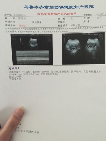 journal_insert_pic_451135113