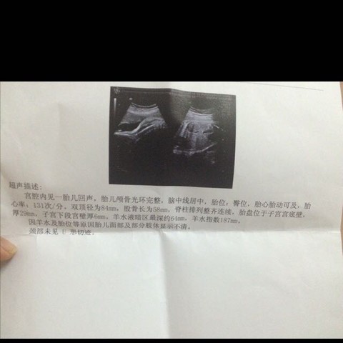 journal_insert_pic_450870431