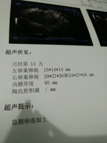 journal_insert_pic_450994411
