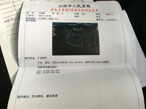 journal_insert_pic_451724693
