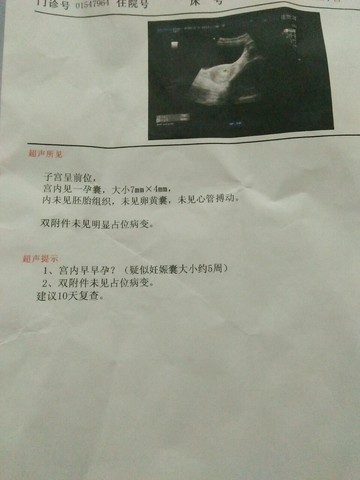 journal_insert_pic_452283980