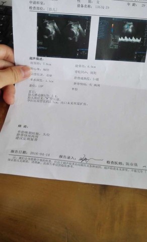 journal_insert_pic_452468601