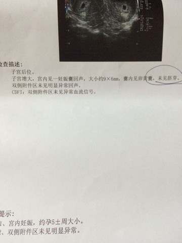 journal_insert_pic_453812908