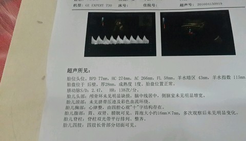 journal_insert_pic_453534723