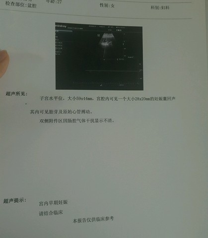journal_insert_pic_454991824
