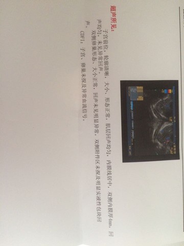journal_insert_pic_455862060