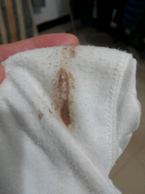 像这样子是什麼情况