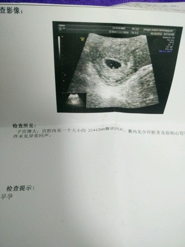 journal_insert_pic_457725173