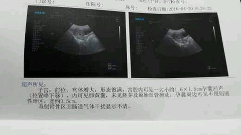 journal_insert_pic_458508012