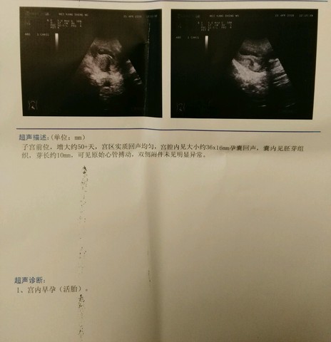 journal_insert_pic_458193730